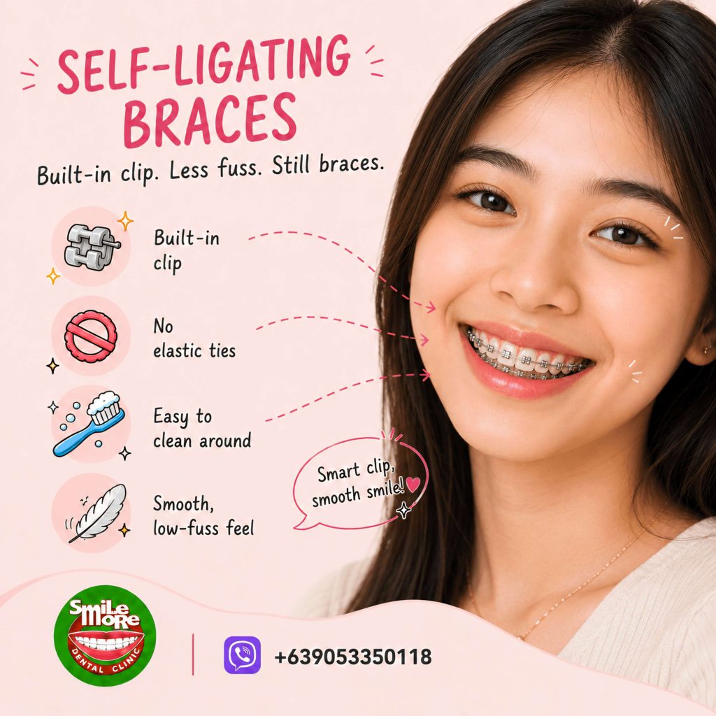 Young woman smiling with self-ligating braces that use built-in clips instead of elastic ties
