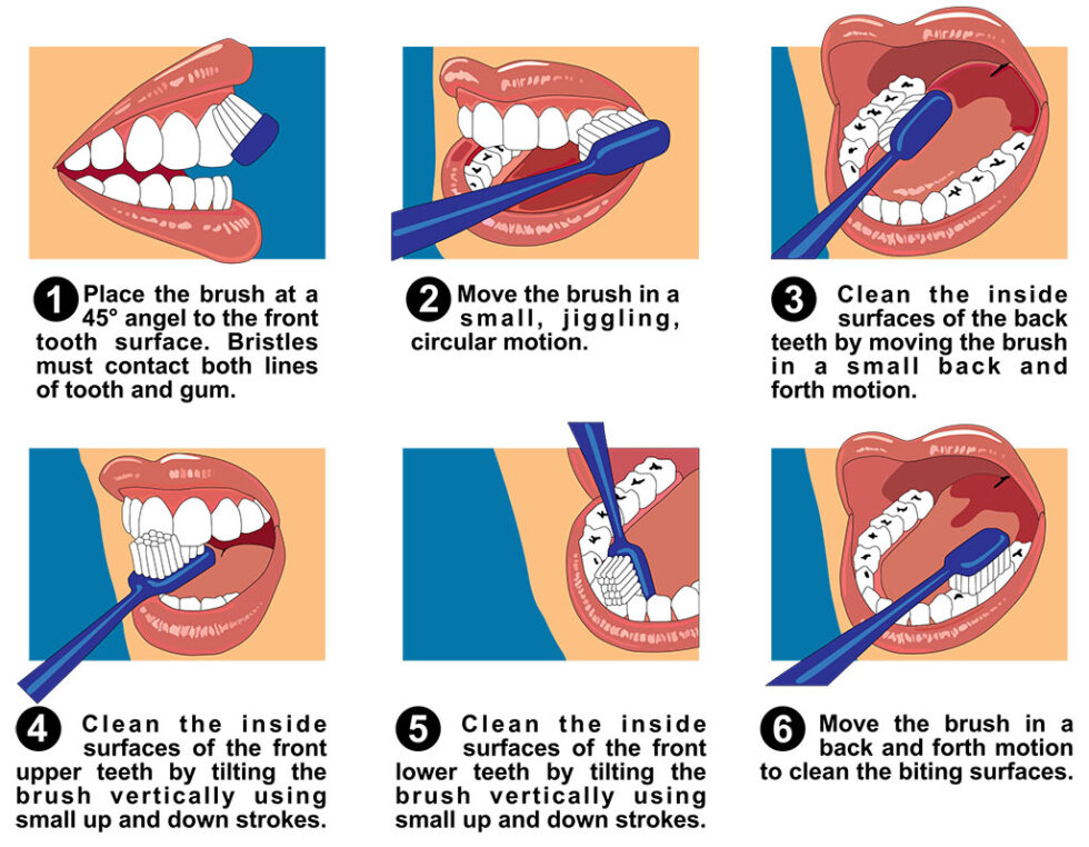 Oral Hygiene Essentials Smile More Dental Clinic