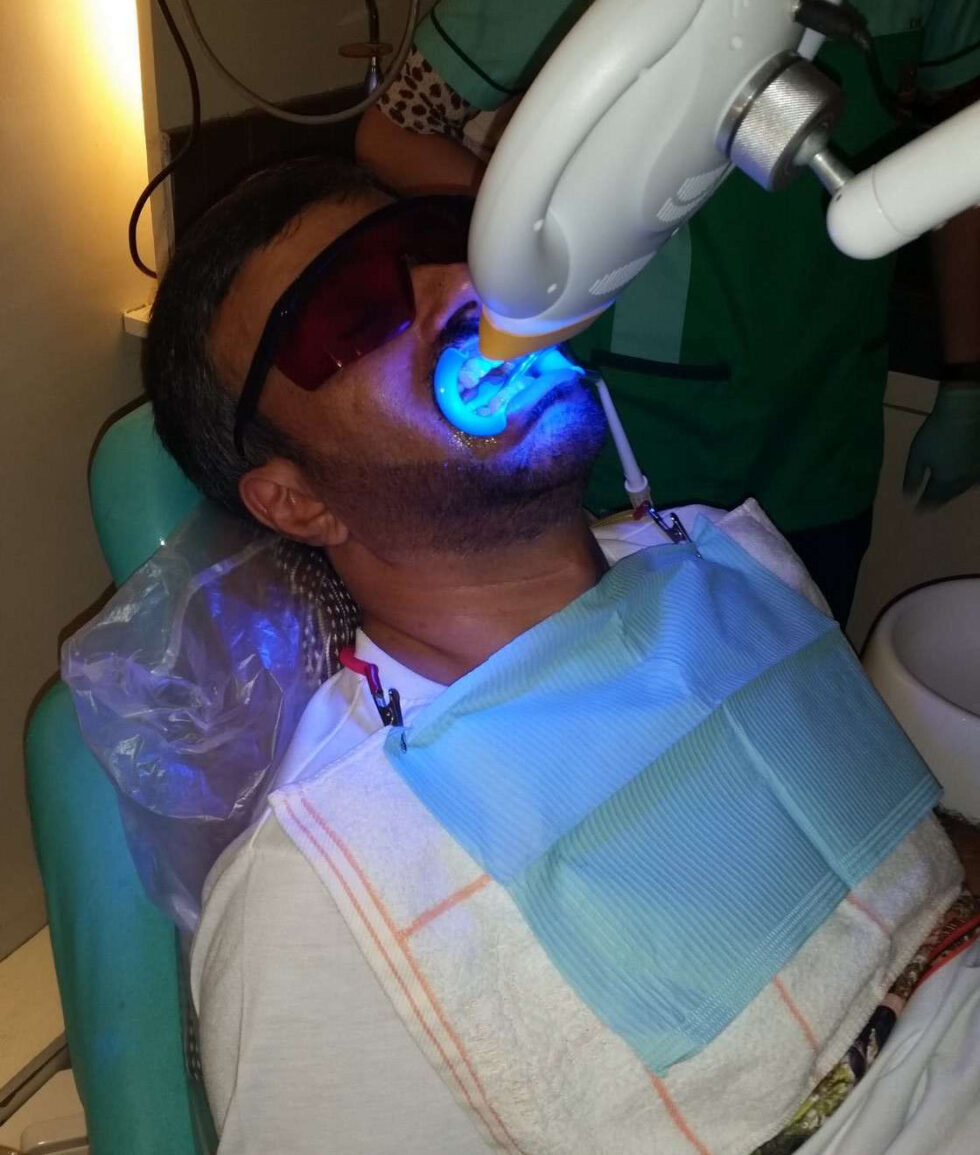 Professional Teeth Whitening in Manila, Philippines Whiter Teeth