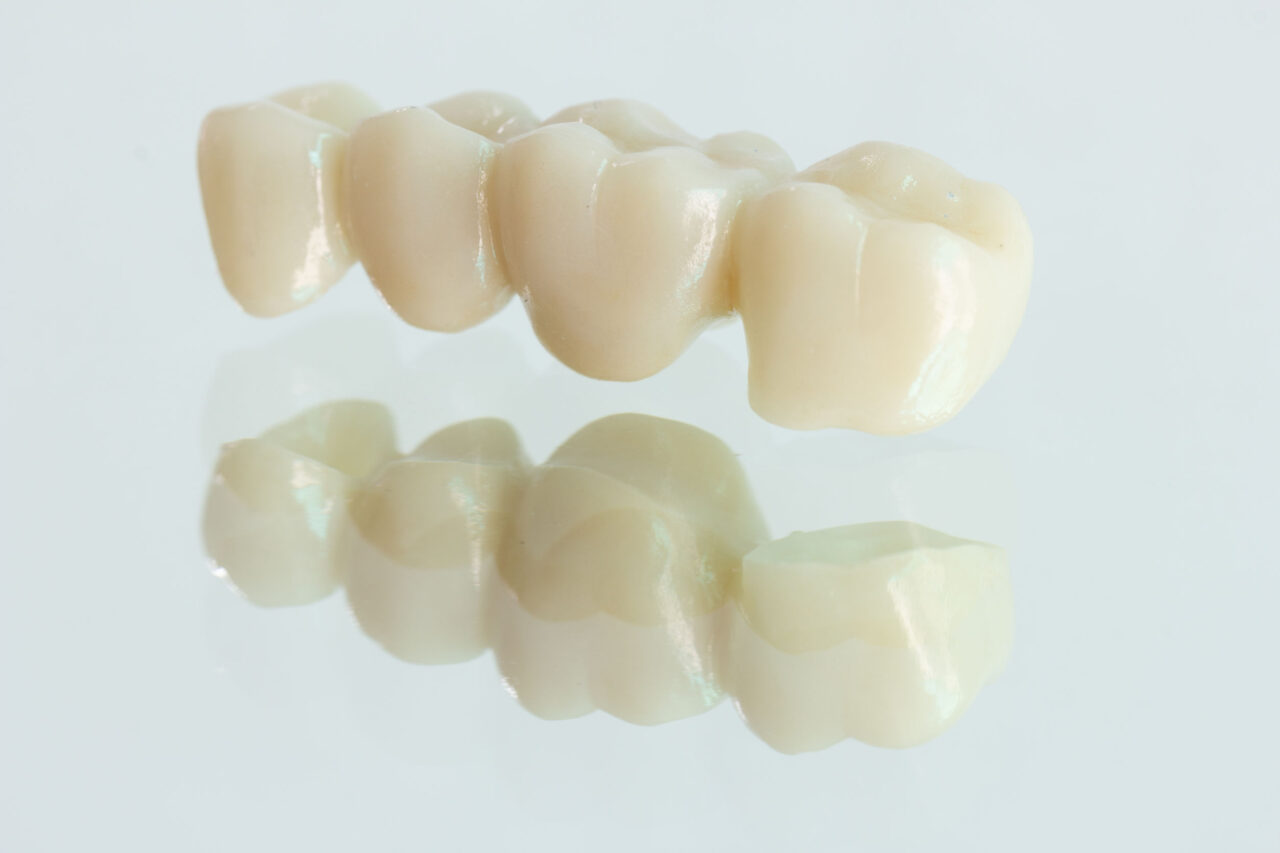 Zirconia Dental Crowns,Fixed Bridges & Veneers Cosmetic Dentist